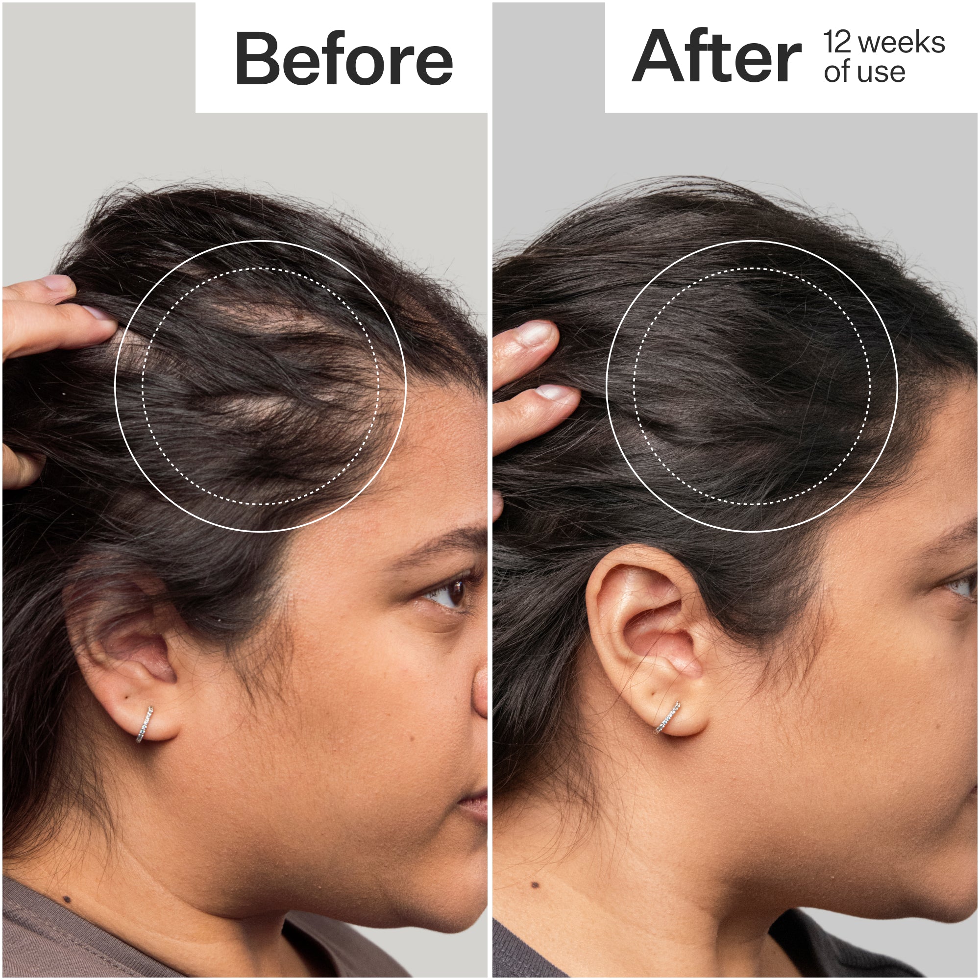3% Stem Cell Peptide Treatment