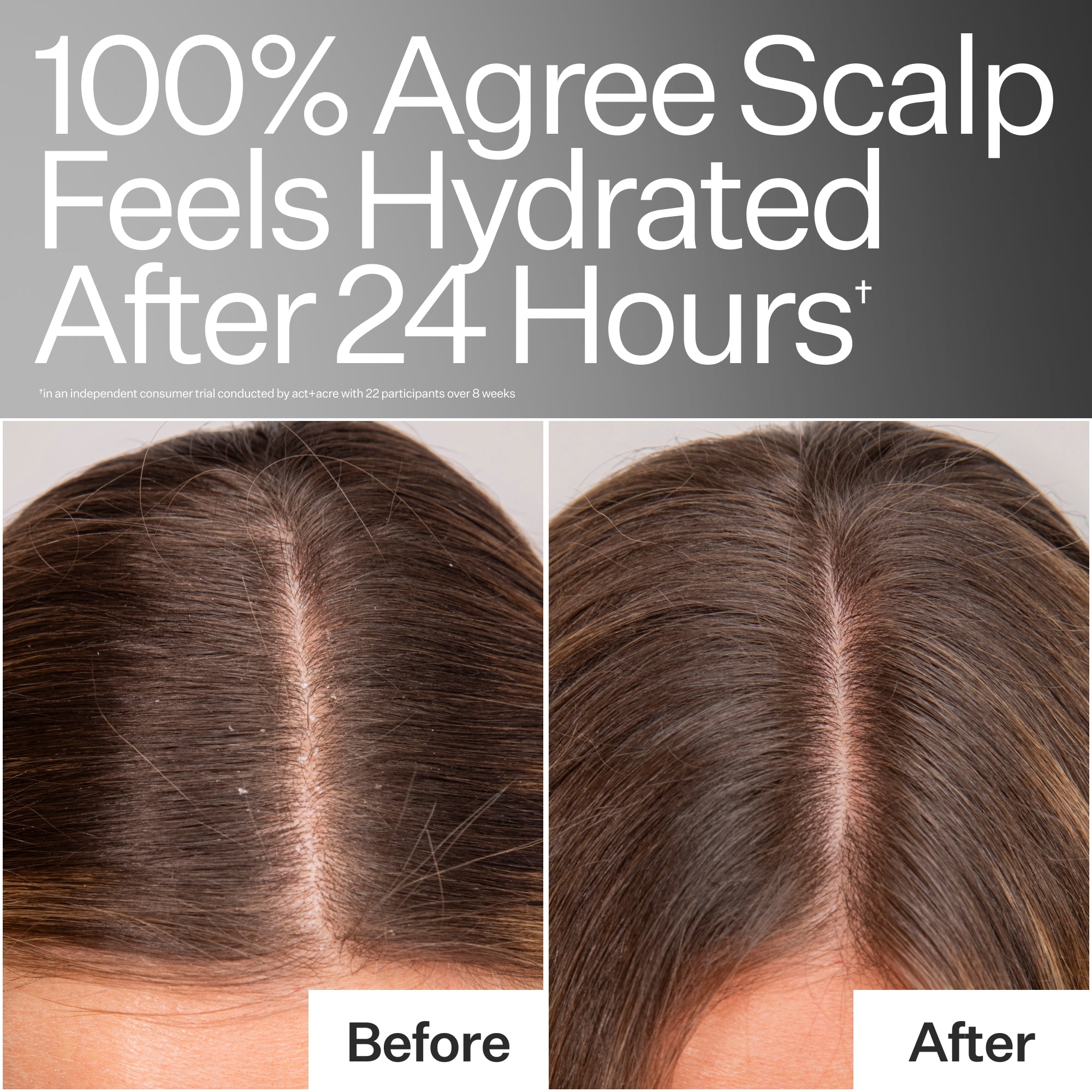 Daily Hydro™ Scalp Serum
