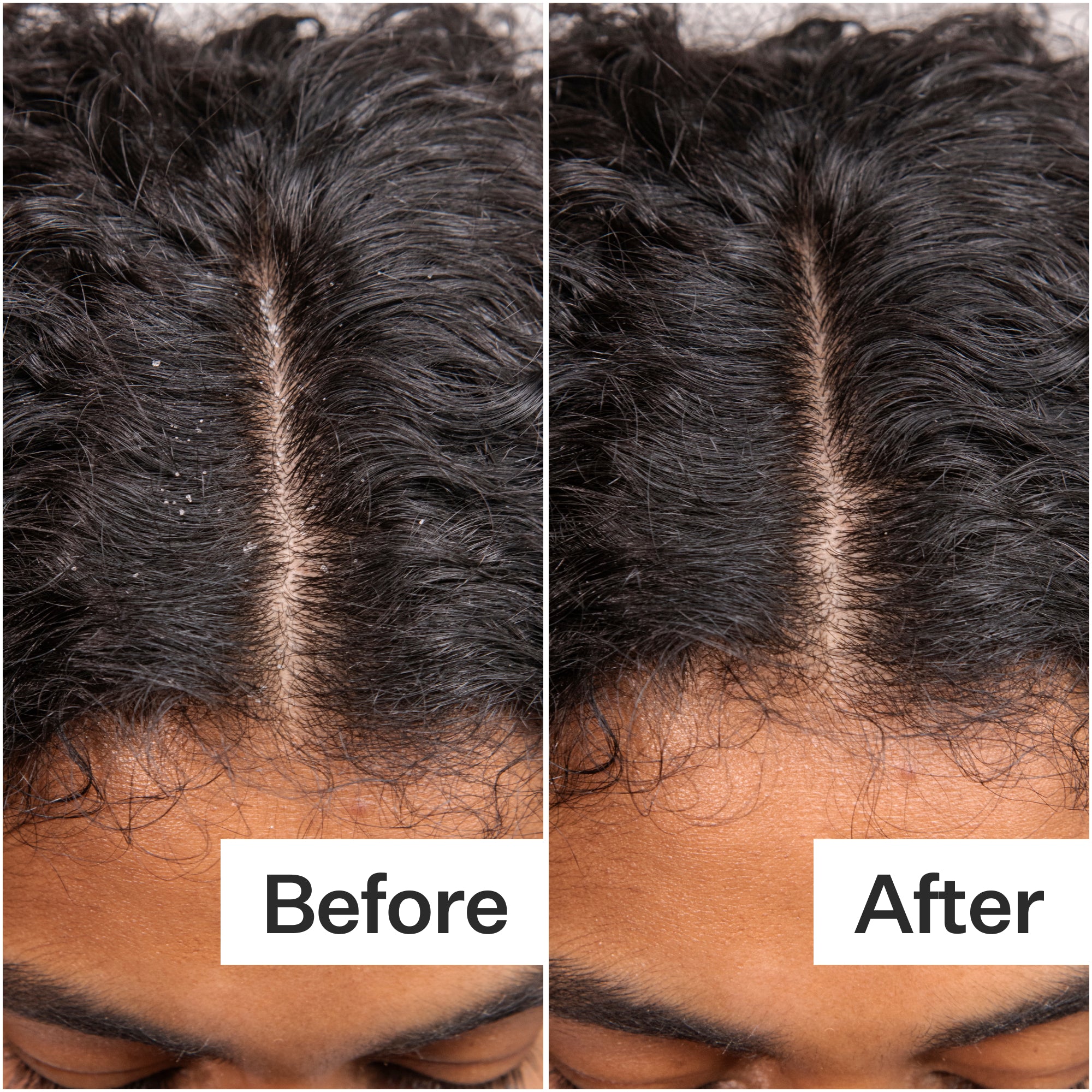 Daily Hydro™ Scalp Serum