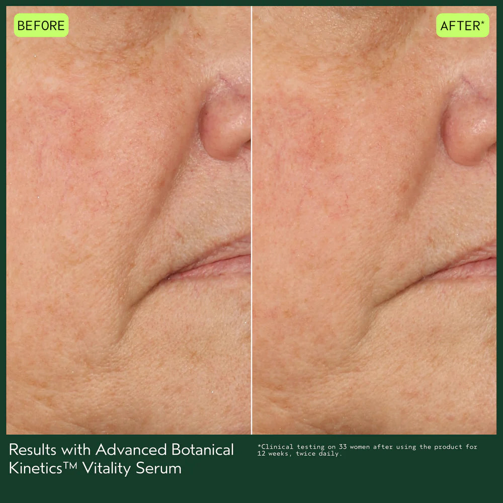 Advanced Botanical Kinetics Vitality Serum 30ml